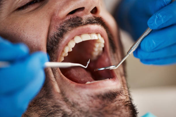 Best Urgent Dental Care for Toothache in Newtown Grant, PA
